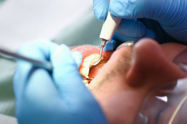 Best Dentist for Tooth Abscess  in North Prairie, WI