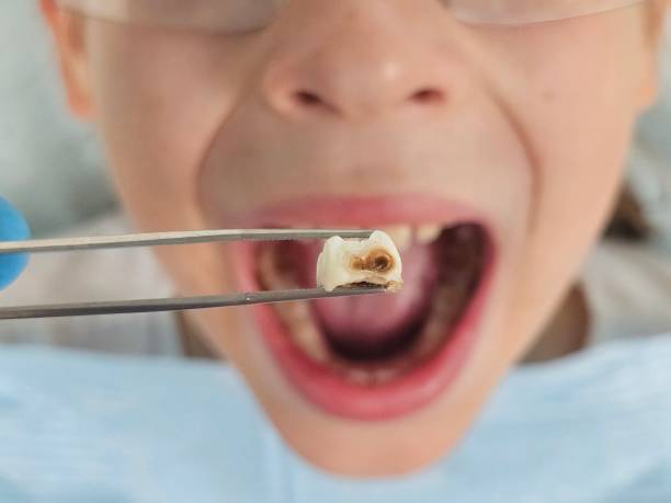 Best Emergency Gum Pain Relief  in North Prairie, WI
